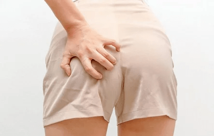 Coceira anal