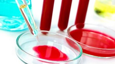 Exame de sangue para parasitas