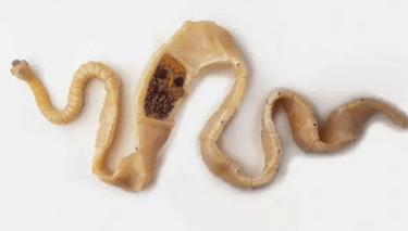 Como descobrir a presença de parasitas no corpo